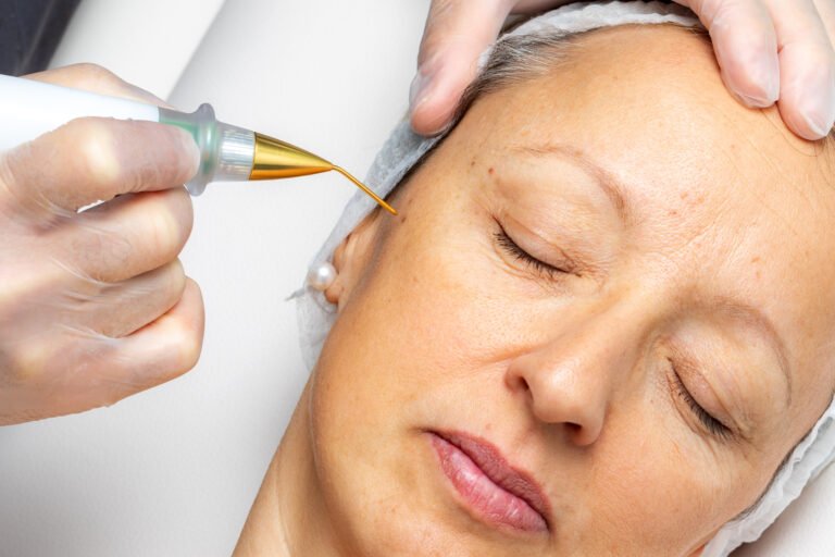 FORMATION PLASMA LIFT